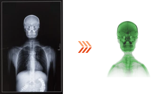 Skeleton Image Comparison
